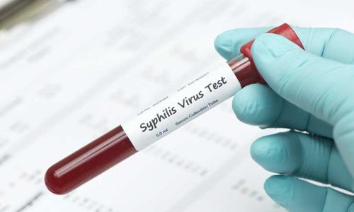 Xét nghiệm giang mai ( syphilis ) là gì?